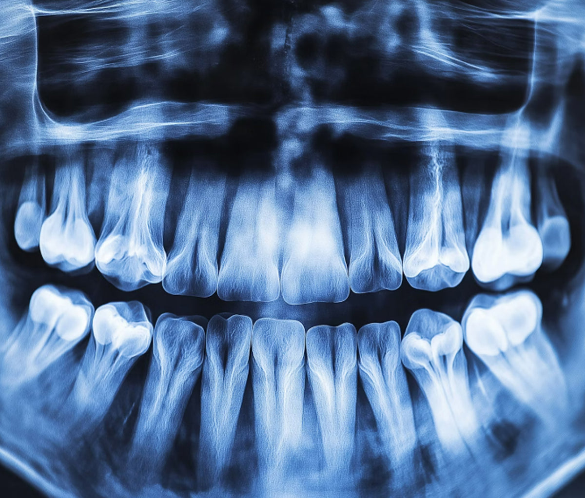 ORAL & MAXILLOFACIAL SURGERY