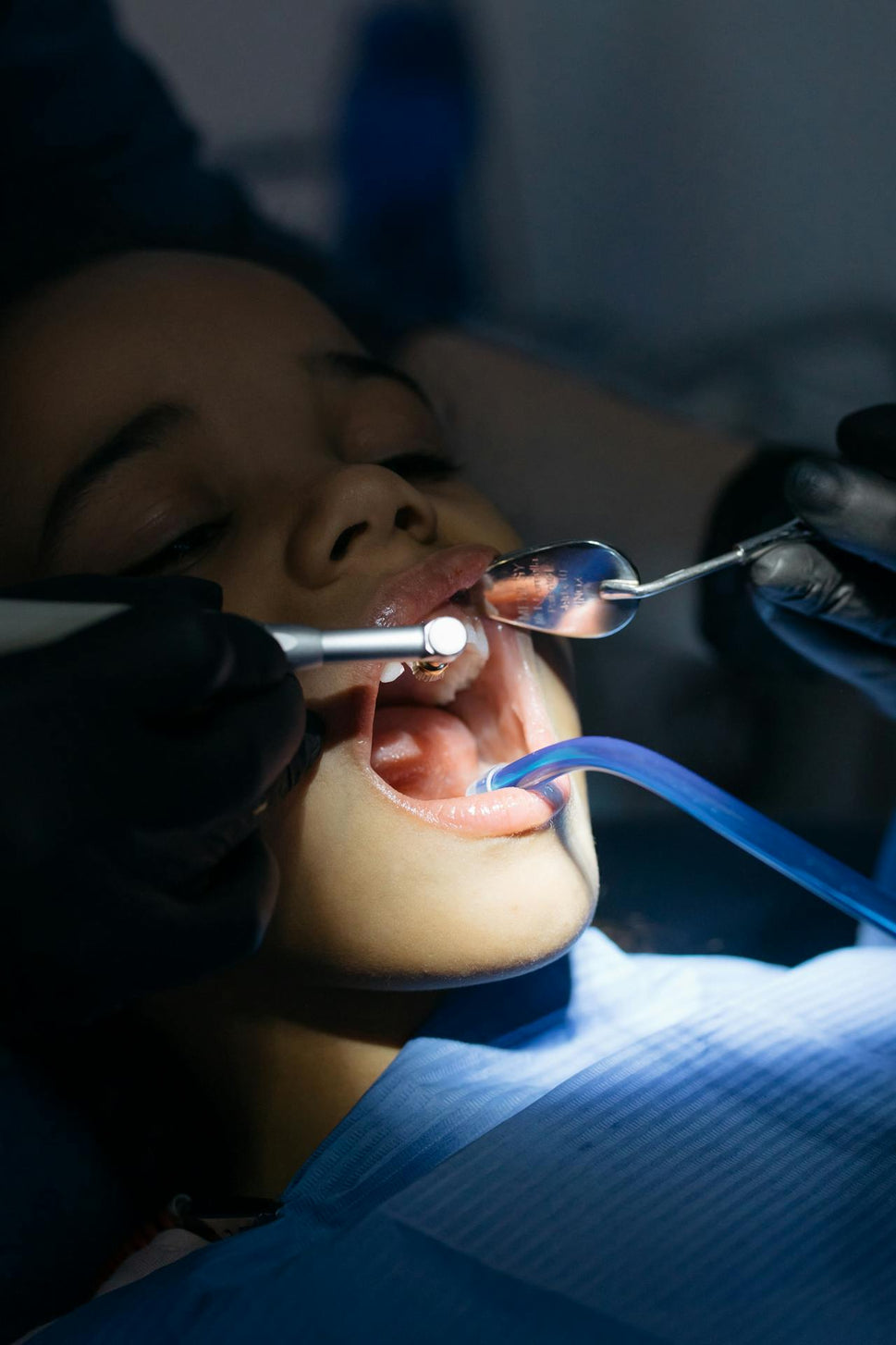 Cavity Prevention