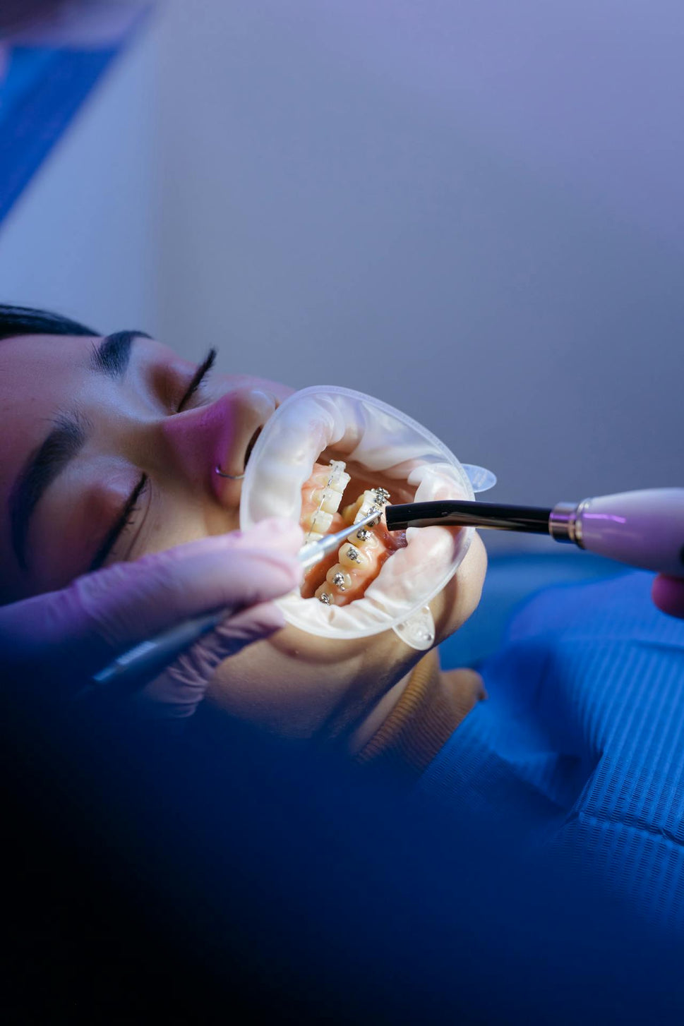 Cosmetic Dentistry